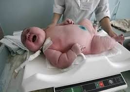 世界最大の赤ちゃん　Ademilton